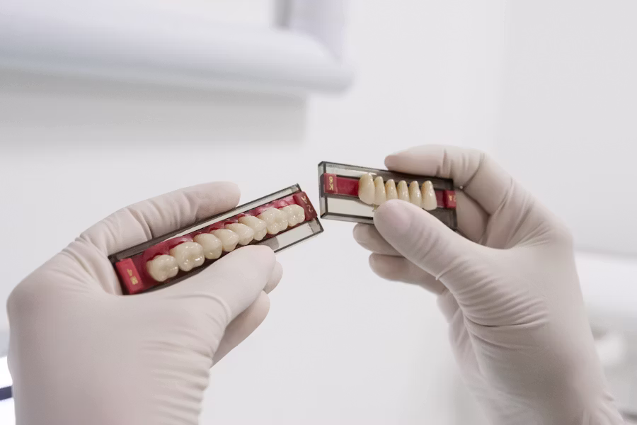 Cura dell'impianto dentale — Studio Dentistico Dott. Bruno Appi