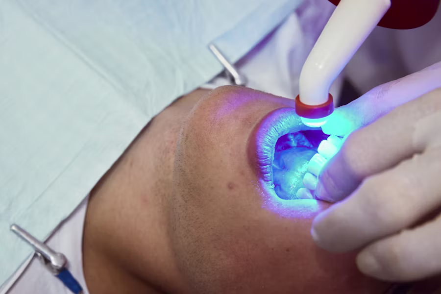 Sbiancamento denti professionale in studio — Studio Dentistico Dott. Bruno Appi