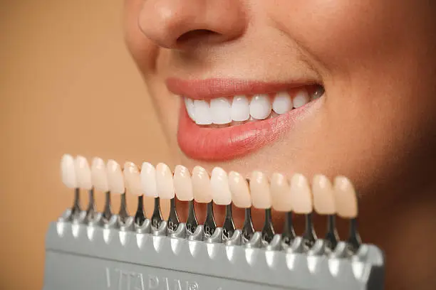 Sorriso perfetto con trattamenti di estetica dentale — Studio Dentistico Dott. Bruno Appi